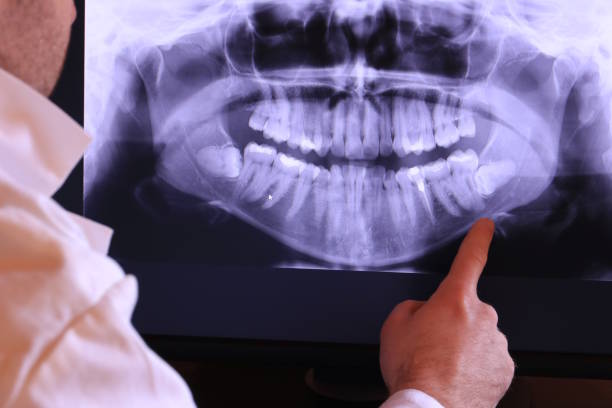 Best Emergency Wisdom Teeth Removal in Van Buren, AR