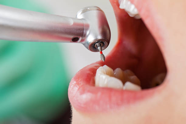 Best Urgent Care for Lost Fillings or Crowns in Van Buren, AR